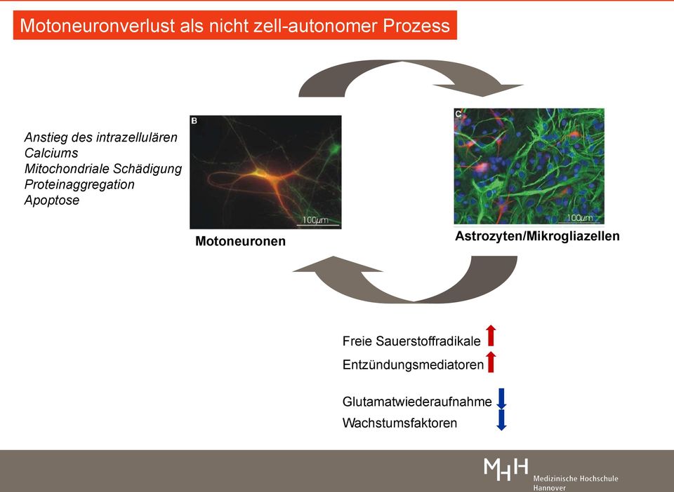 Proteinaggregation Apoptose Motoneuronen Astrozyten/Mikrogliazellen