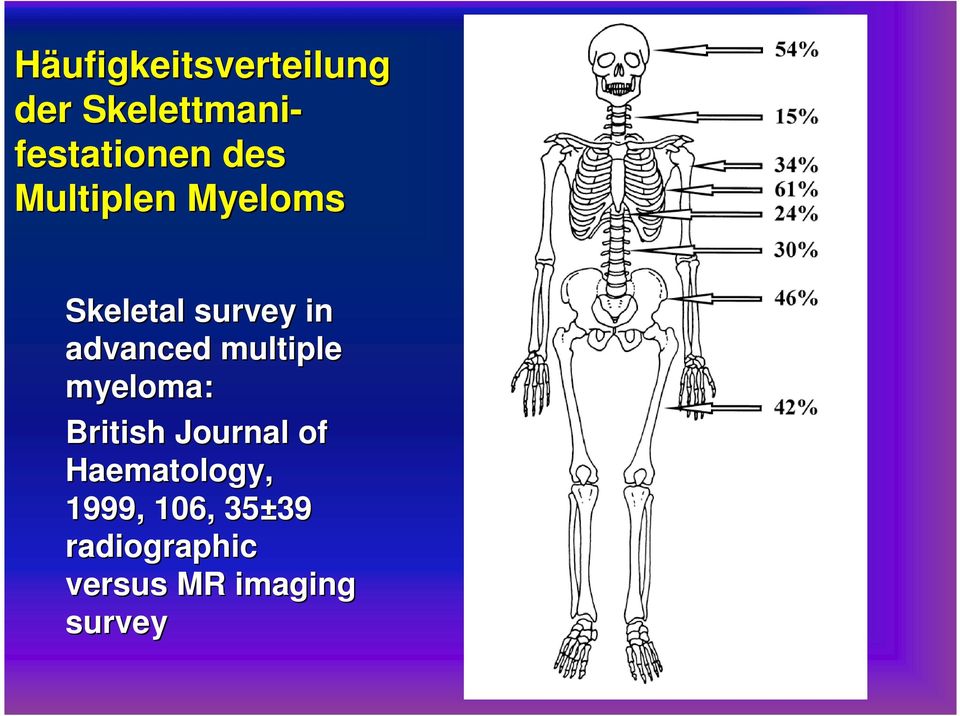 multiple myeloma: British Journal of Haematology,