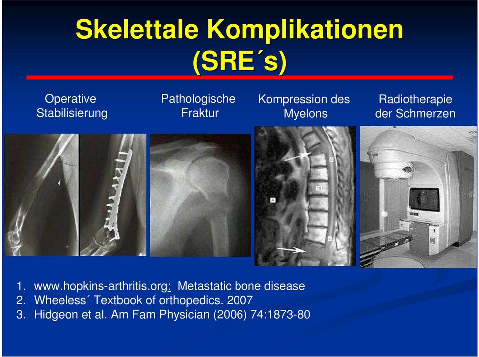 Schmerzen 1. www.hopkins-arthritis.org: Metastatic bone disease 2.