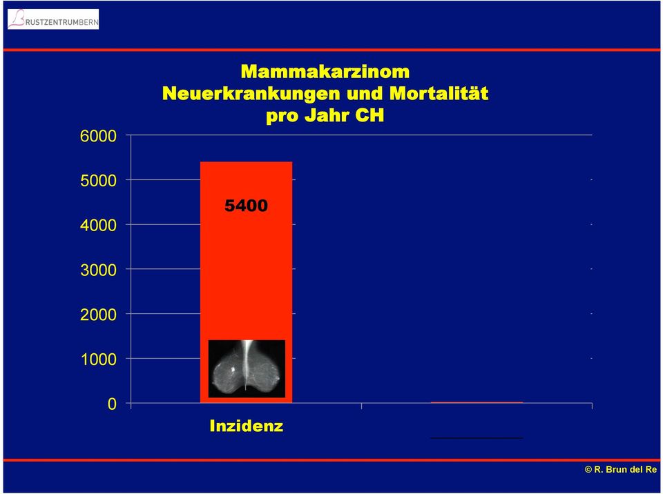 Mortalität pro Jahr CH 5400