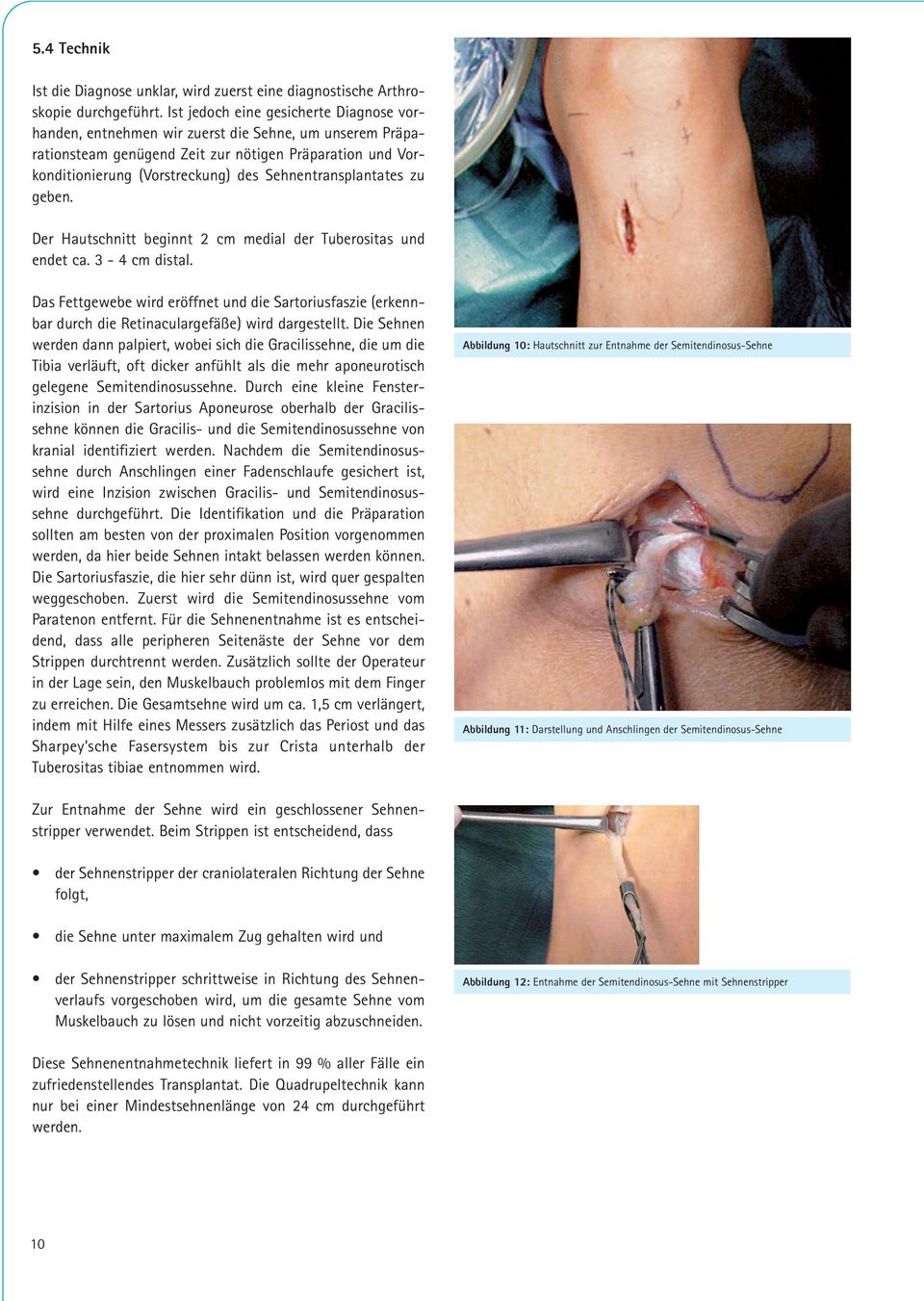 Sehnentransplantates zu geben. Der Hautschnitt beginnt 2 cm medial der Tuberositas und endet ca. 3-4 cm distal.