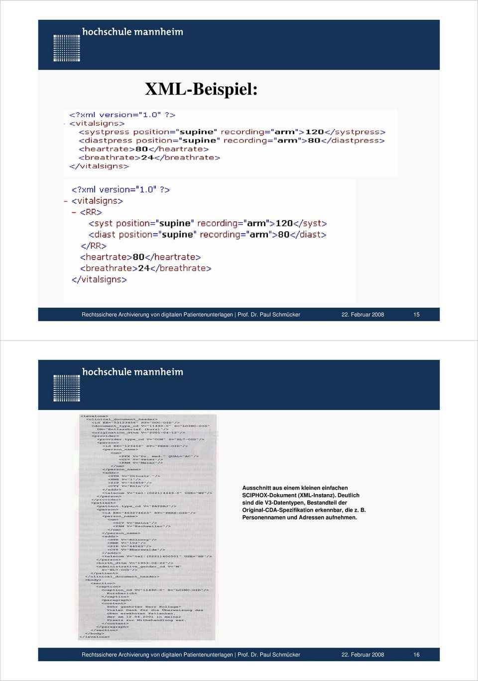 Deutlich sind die V3-Datentypen, Bestandteil der Original-CDA-Spezifikation erkennbar, die z. B. Personennamen und Adressen aufnehmen.