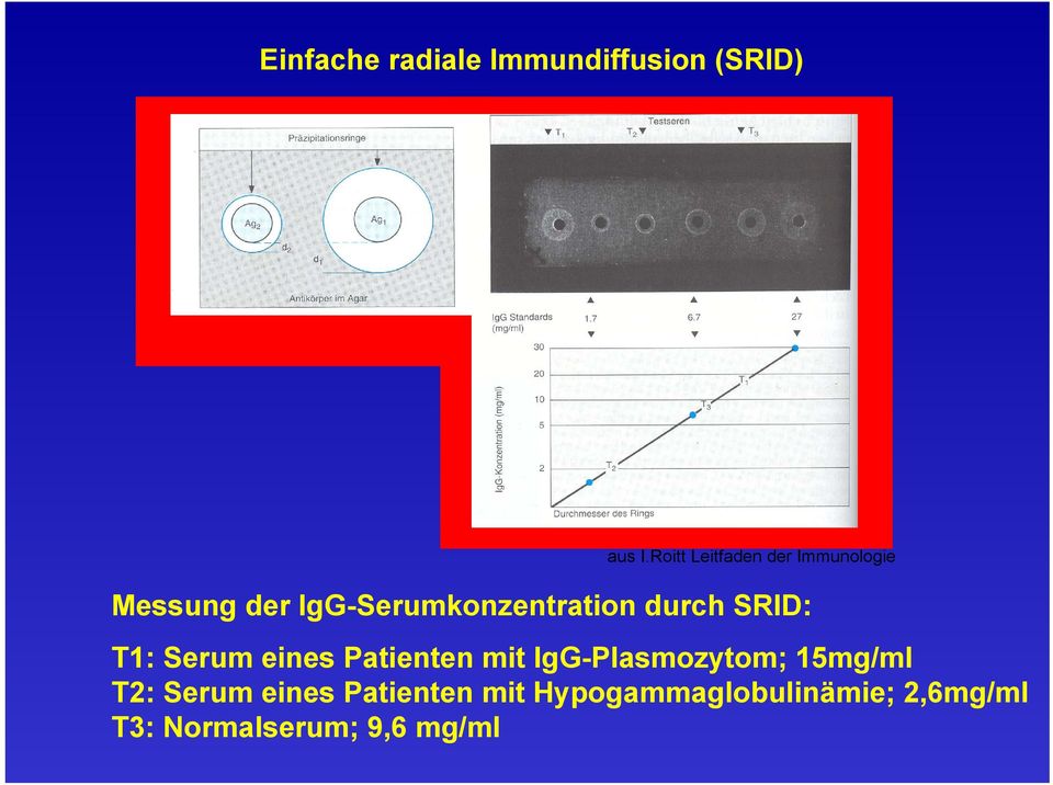 durch SRID: T1: Serum eines Patienten mit IgG-Plasmozytom; 15mg/ml
