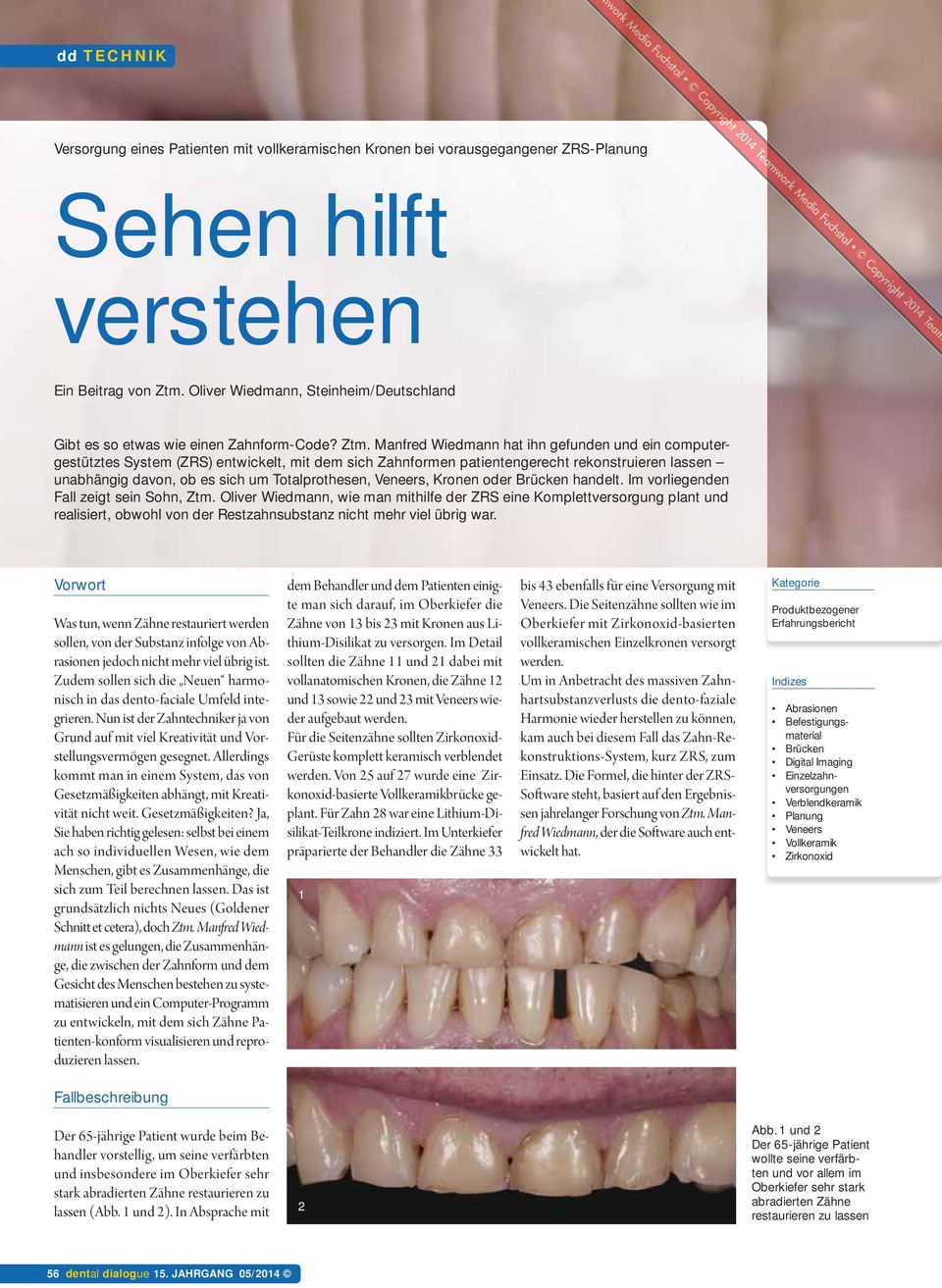 Manfred Wiedmann hat ihn gefunden und ein computergestütztes System (ZRS) entwickelt, mit dem sich Zahnformen patientengerecht rekonstruieren lassen unabhängig davon, ob es sich um Totalprothesen,