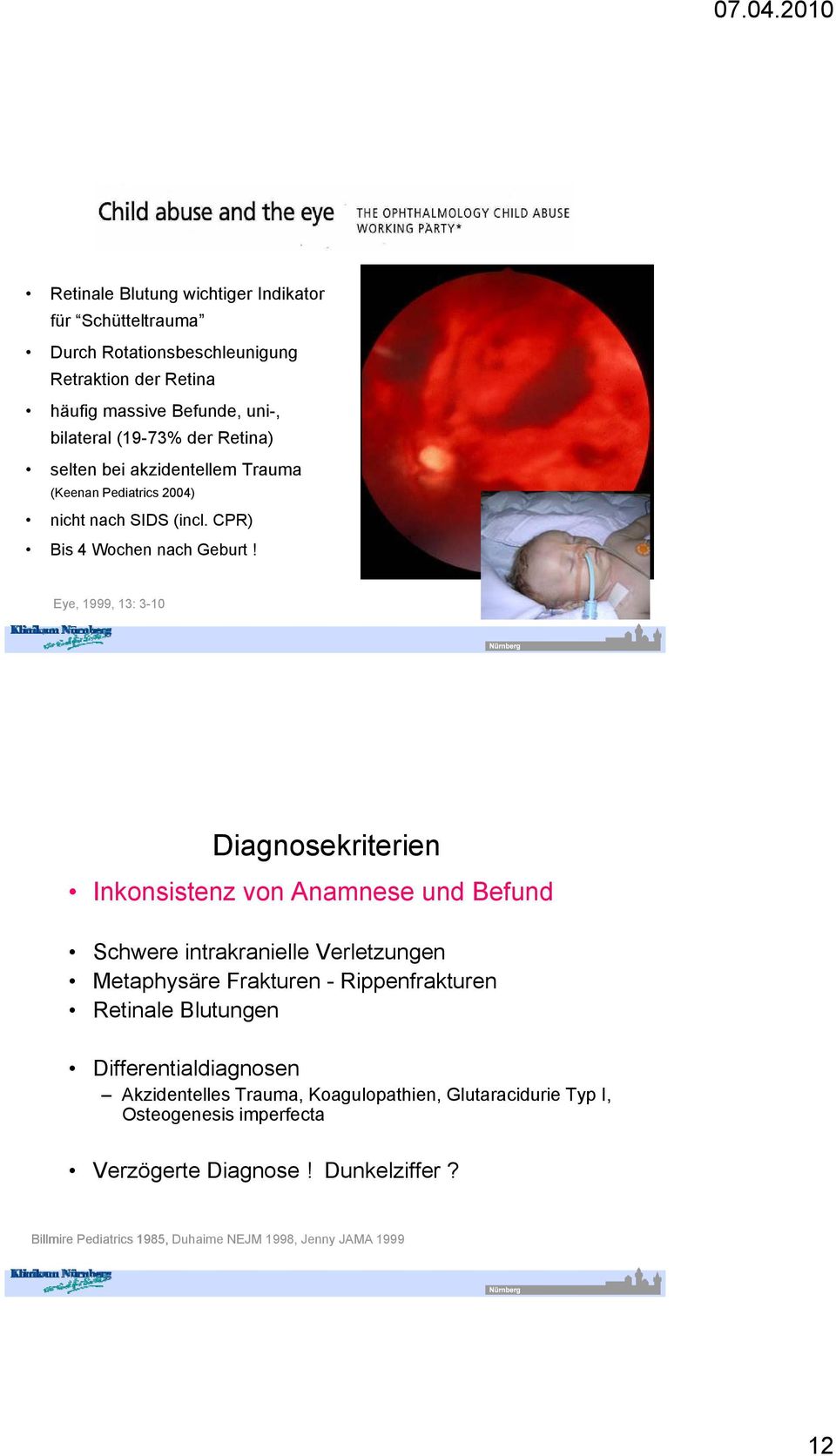 Eye, 1999, 13: 3-10 Diagnosekriterien Inkonsistenz von Anamnese und Befund Schwere intrakranielle Verletzungen Metaphysäre Frakturen - Rippenfrakturen Retinale