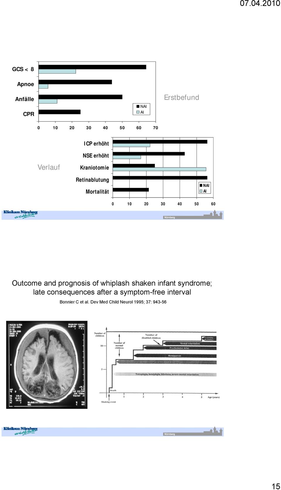 60 Outcome and prognosis of whiplash shaken infant syndrome; late consequences