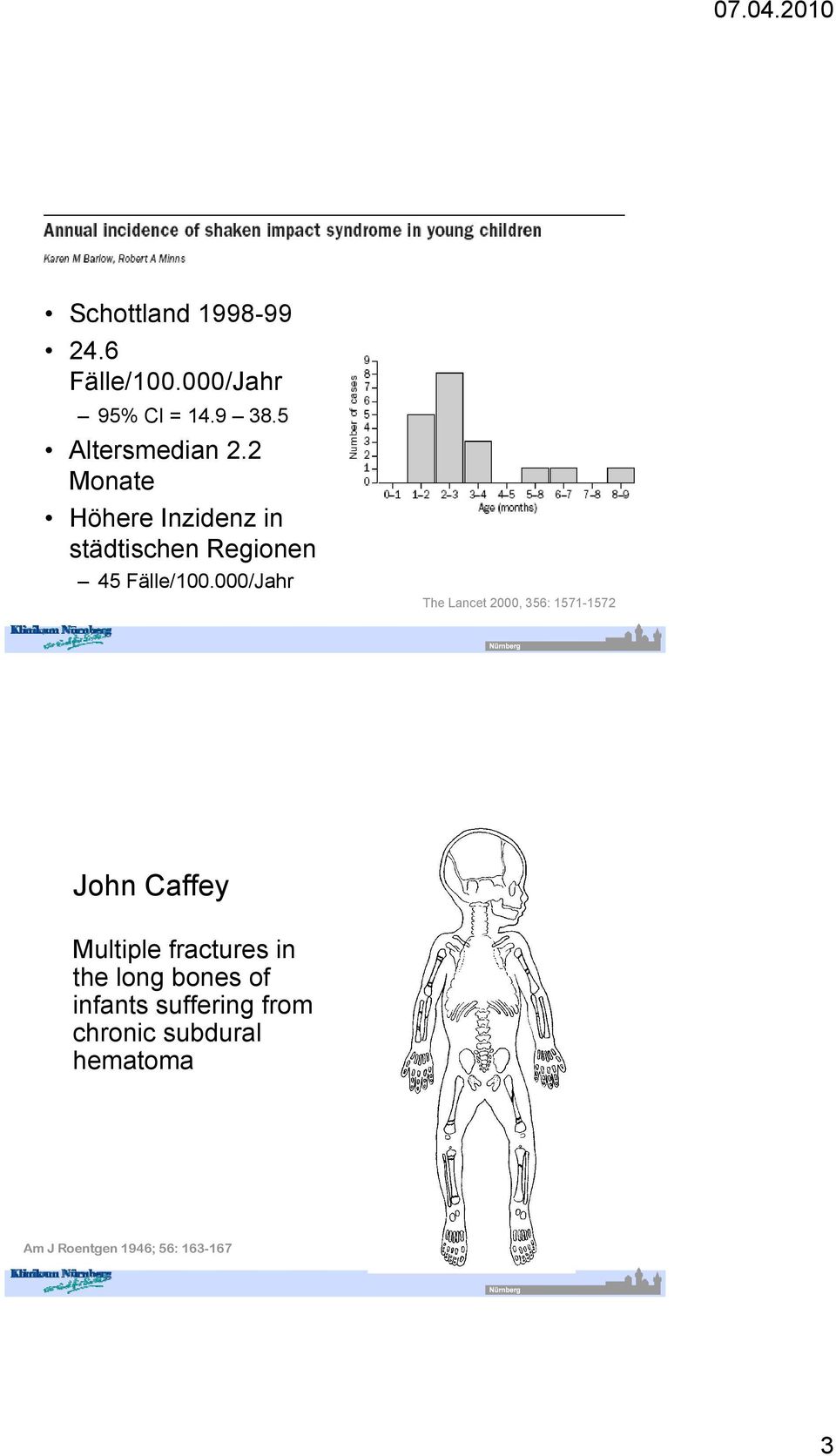 000/Jahr N=19 The Lancet 2000, 356: 1571-1572 John Caffey Multiple fractures in