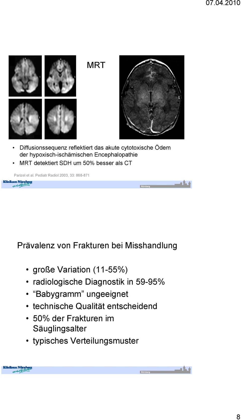 Pediatr Radiol 2003, 33: 868-871 Prävalenz von Frakturen bei Misshandlung große Variation (11-55%)