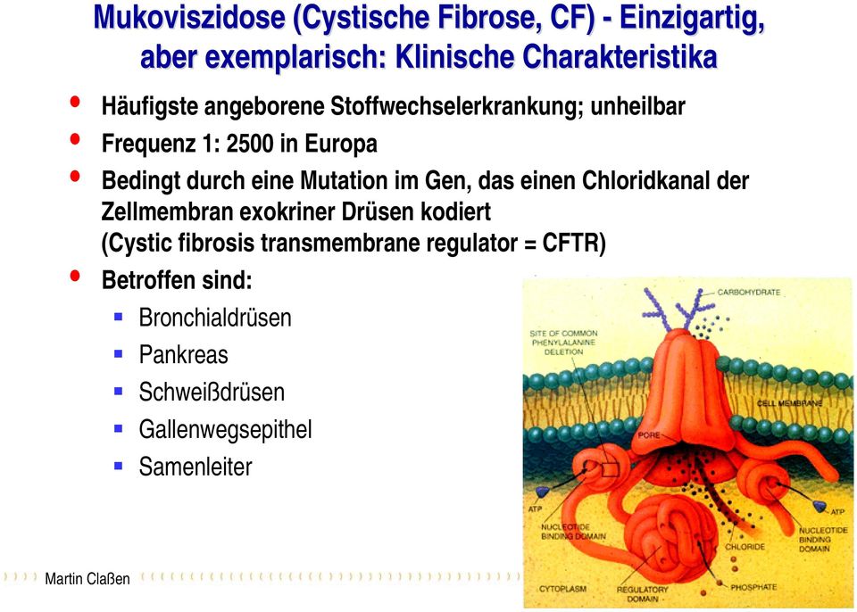 Mutation im Gen, das einen Chloridkanal der Zellmembran exokriner Drüsen kodiert (Cystic fibrosis