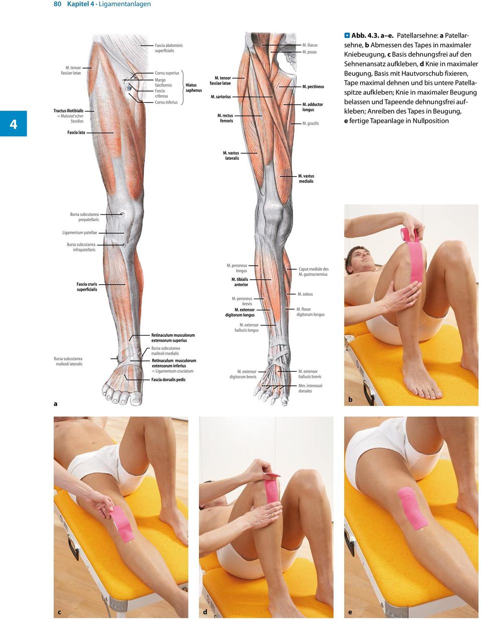 Sehnenansatz aufkleben, d Knie in maximaler Beugung, Basis mit Hautvorschub fixieren, Tape maximal dehnen und