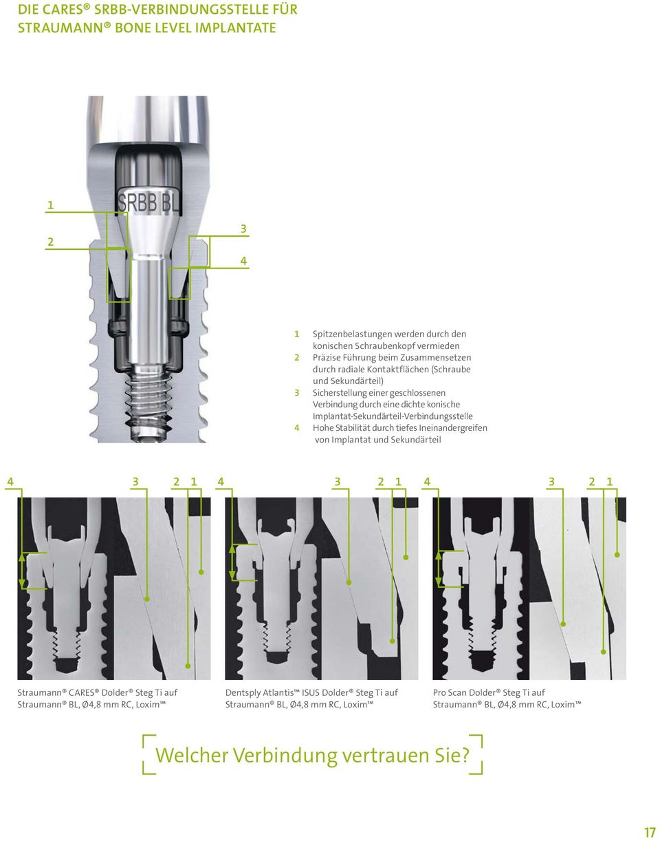 Implantat-Sekundärteil-Verbindungsstelle 4 Hohe Stabilität durch tiefes Ineinandergreifen von Implantat und Sekundärteil 4 3 2 1 4 3 2 1 4 3 2 1 Straumann CARES Dolder Steg Ti