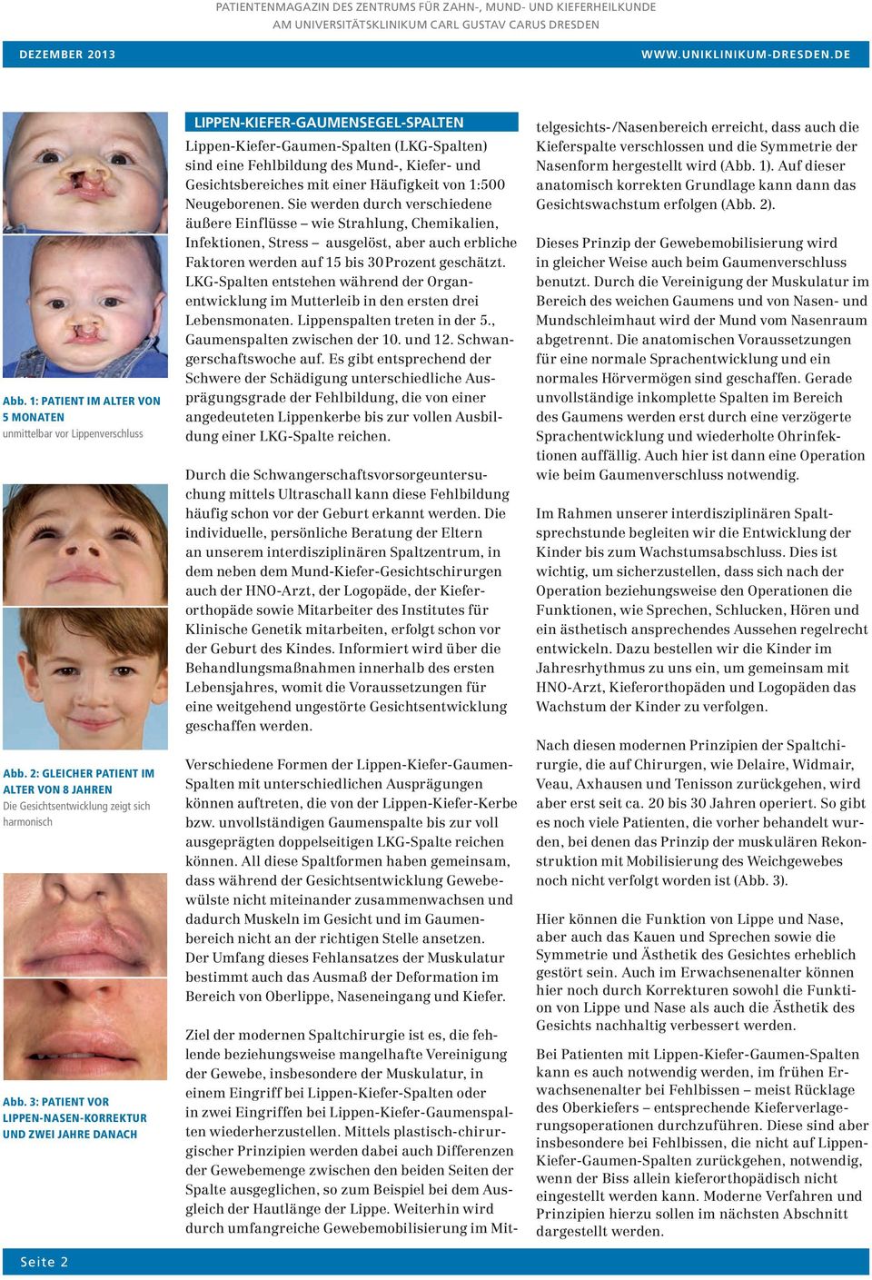 Gesichtsbereiches mit einer Häufigkeit von 1:500 Neugeborenen.