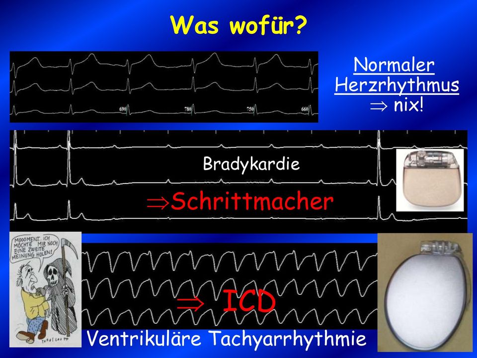 nix! Bradykardie