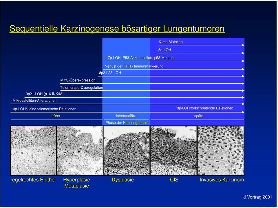 Mikrosatelliten-Alterationen 3p-LOH/kleine telomerische Deletionen frühe intermediäre Phase der Karzinogenese