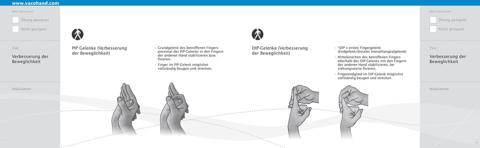 DIP-Gelenke (Verbesserung der Beweglichkeit) *DIP = erstes Fingergelenk (Endgelenk/distales Interphlangealgelenk) Mittelknochen des betroffenen Fingers