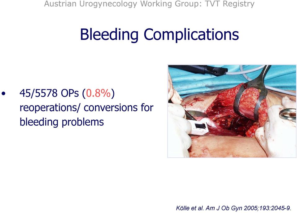 (0.8%) reoperations/ conversions for bleeding