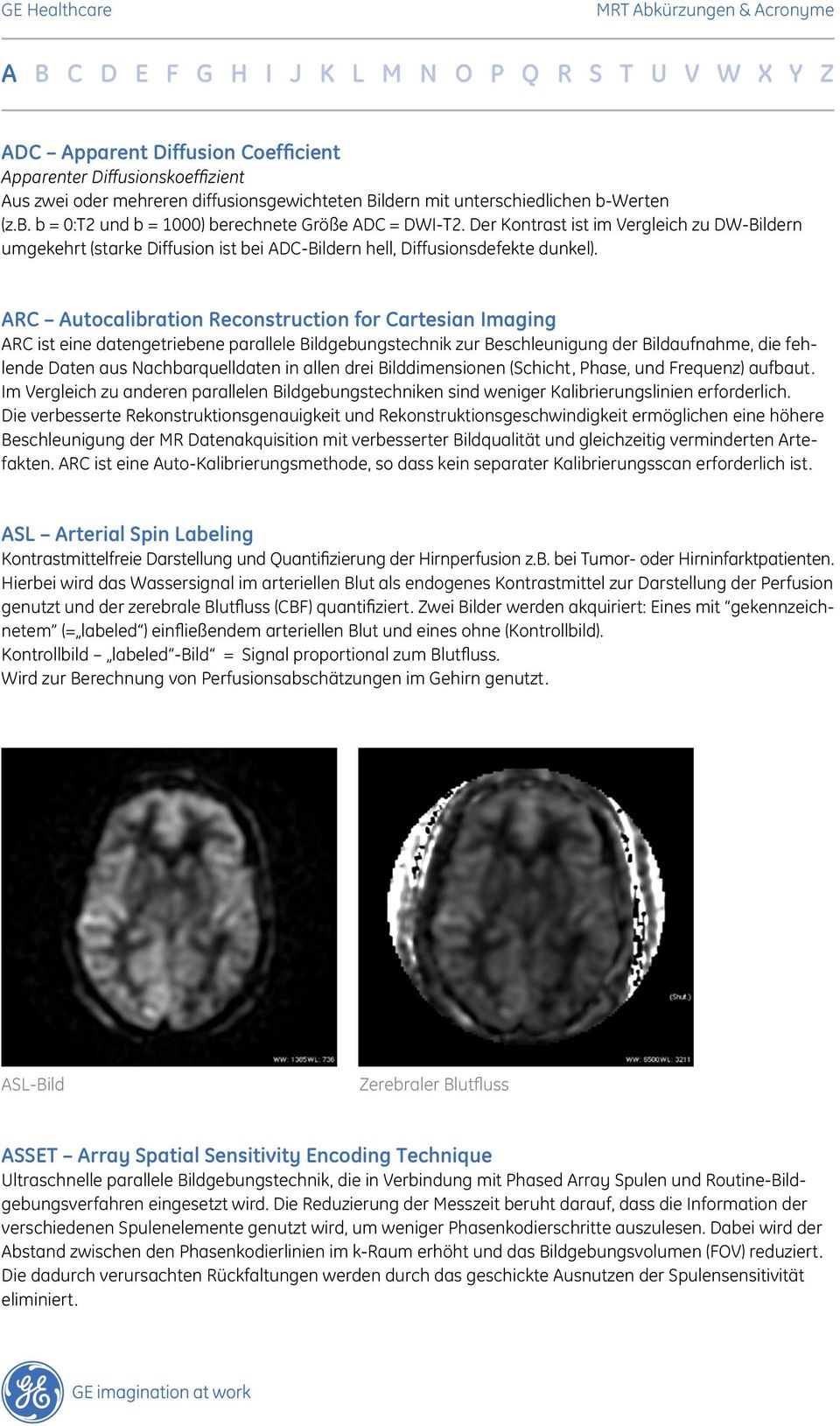ARC Autocalibration Reconstruction for Cartesian Imaging ARC ist eine datengetriebene parallele Bildgebungstechnik zur Beschleunigung der Bildaufnahme, die fehlende Daten aus Nachbarquelldaten in