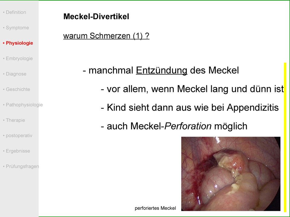 wenn Meckel lang und dünn ist - Kind sieht dann