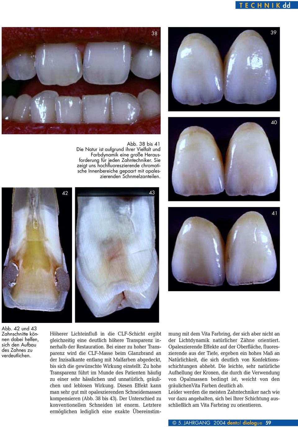 42 und 43 Zahnschnitte können dabei helfen, sich den Aufbau des Zahnes zu verdeutlichen.