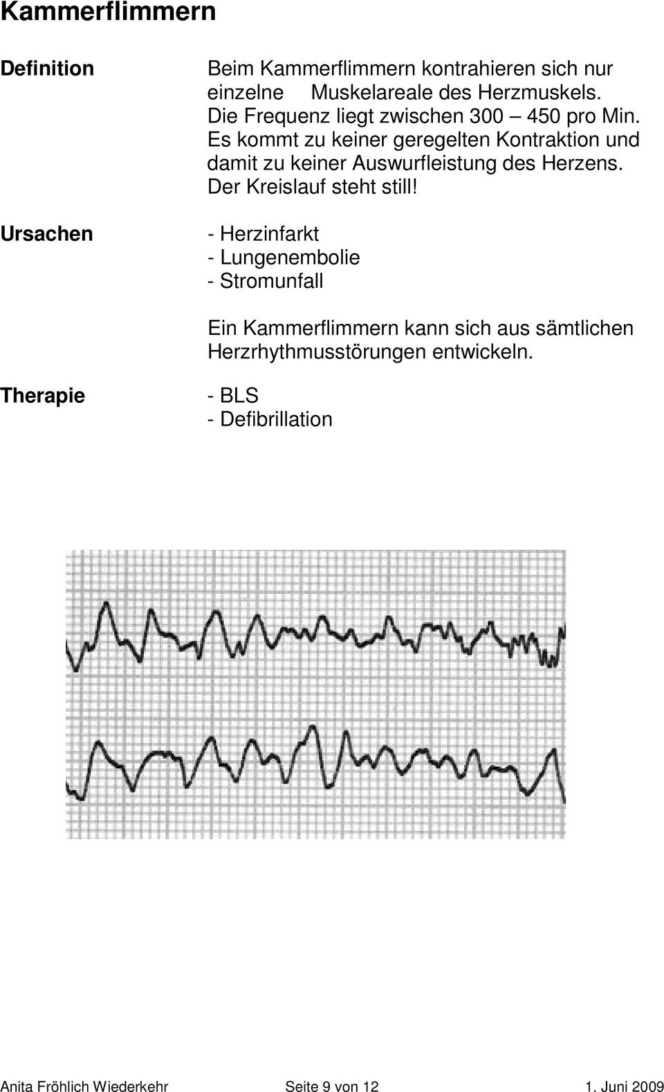 Es kommt zu keiner geregelten Kontraktion und damit zu keiner Auswurfleistung des Herzens. Der Kreislauf steht still!