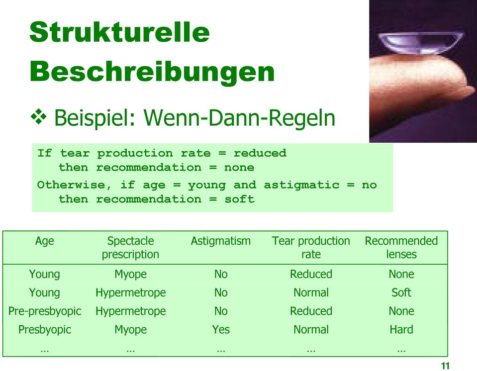 Spectacle prescription Astigmatism Tear production rate Recommended lenses Young Myope No Reduced None