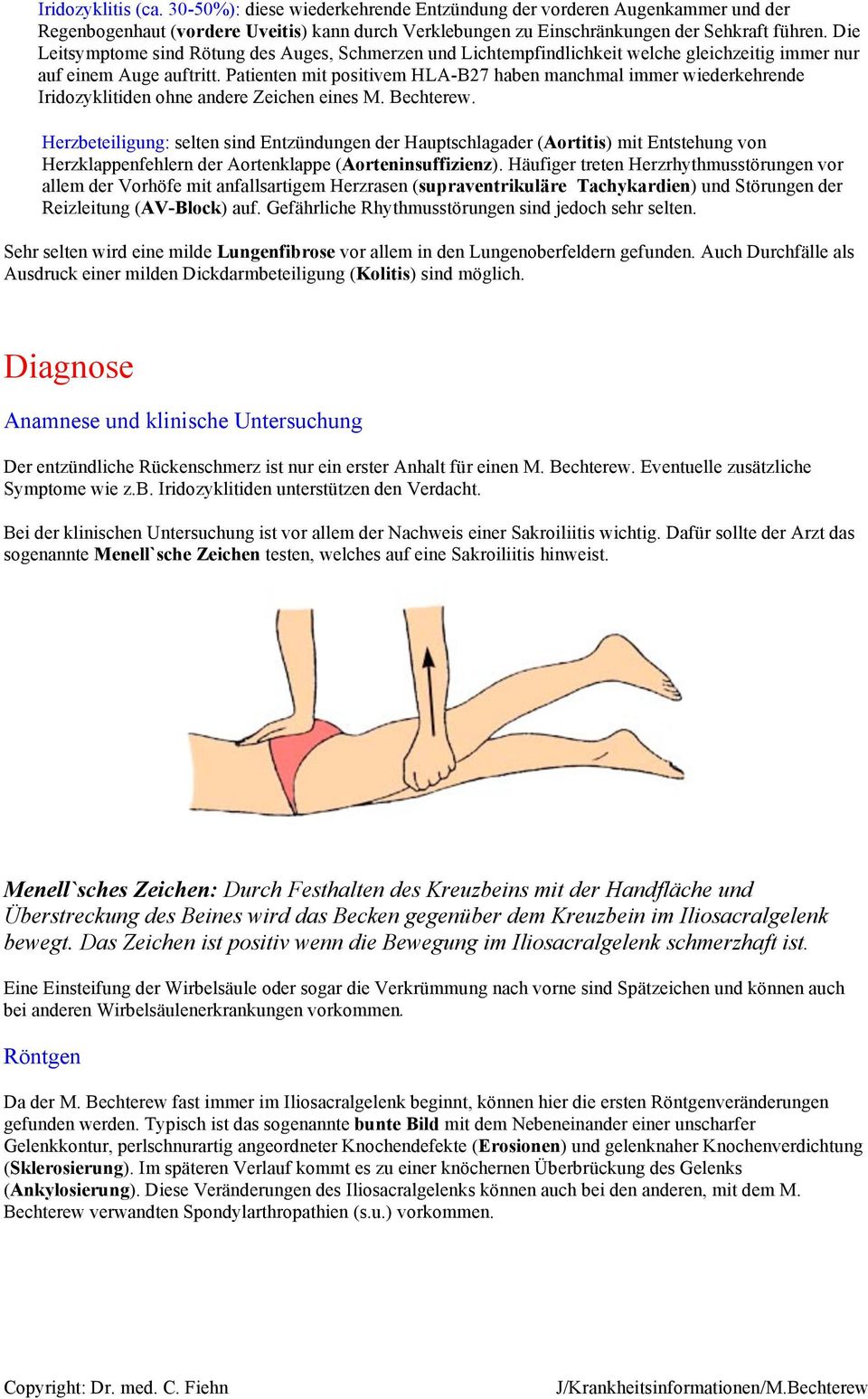 Patienten mit positivem HLA-B27 haben manchmal immer wiederkehrende Iridozyklitiden ohne andere Zeichen eines M. Bechterew.