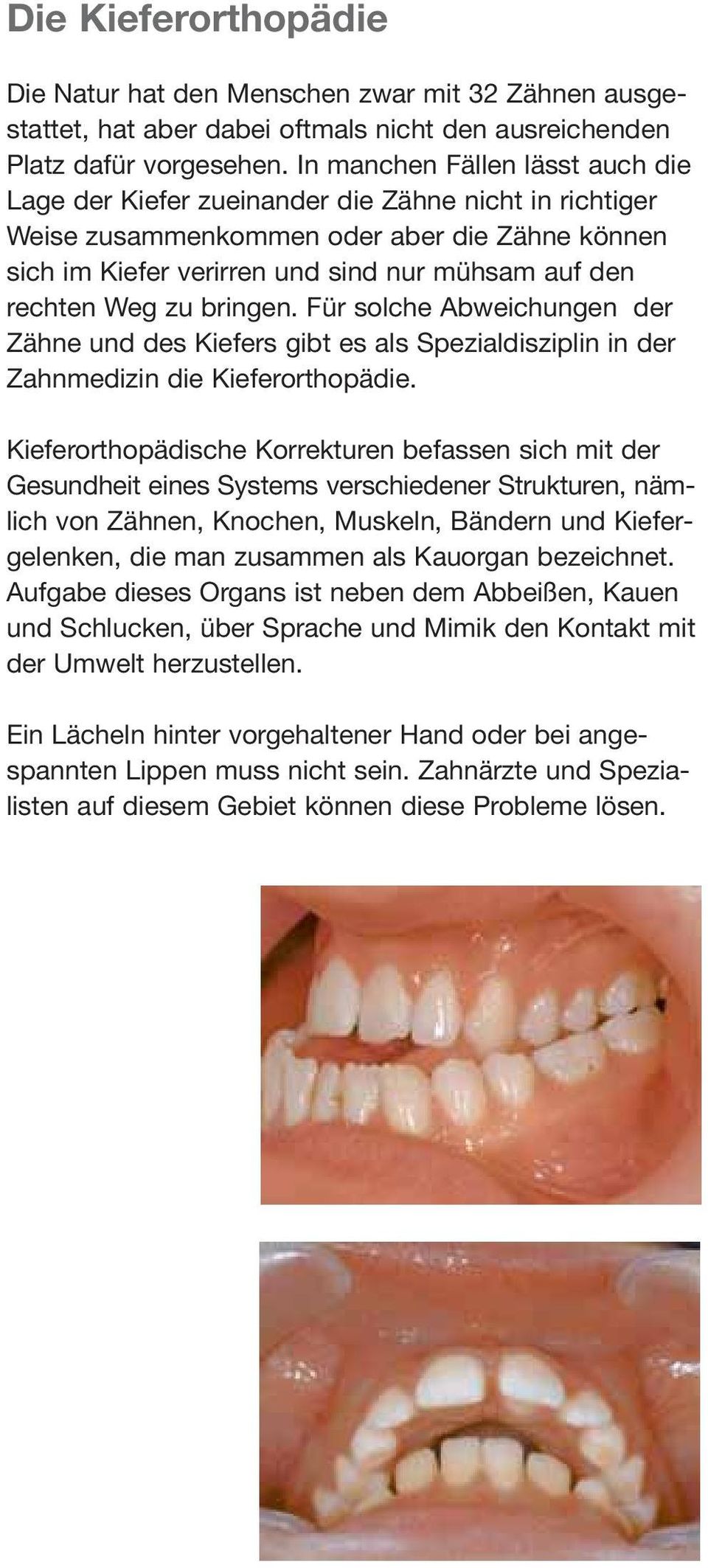 Weg zu bringen. Für solche Abweichungen der Zähne und des Kiefers gibt es als Spezialdisziplin in der Zahnmedizin die Kieferorthopädie.