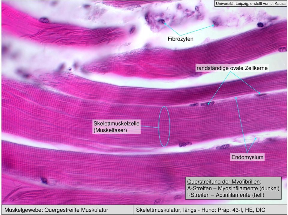 (Muskelfaser) Querstreifung der Myofibrillen: A-Streifen Myosinfilamente