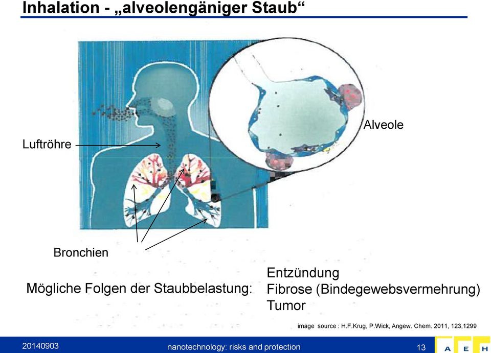 (Bindegewebsvermehrung) Tumor image source : H.F.Krug, P.