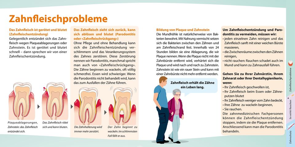 Um Zahnfleischentzündung und Parodontitis zu vermeiden, müssen wir: jeden einzelnen Zahn reinigen und das Zahnfleisch sanft mit einer weichen Bürste massieren, die Zwischenräume zwischen den Zähnen