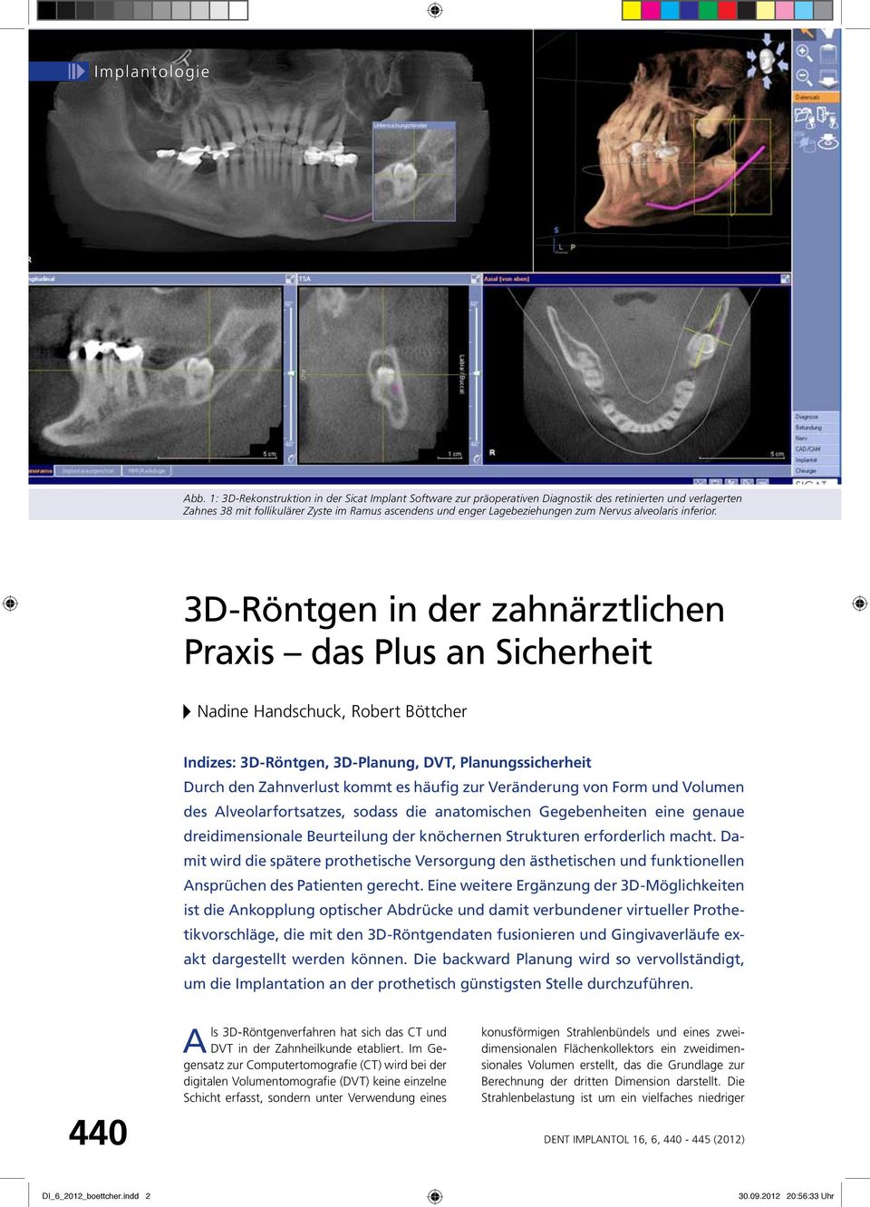 3D-Röntgen in der zahnärztlichen Praxis das Plus an Sicherheit Nadine Handschuck, Robert Böttcher Indizes: 3D-Röntgen, 3D-Planung, DVT, Planungssicherheit Durch den Zahnverlust kommt es häufig zur