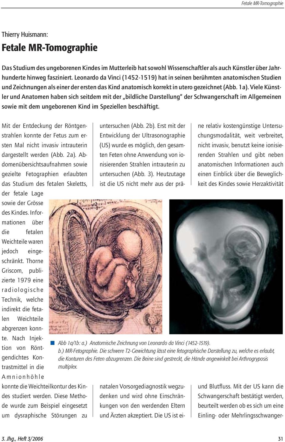 Viele Künstler und Anatomen haben sich seitdem mit der bildliche Darstellung der Schwangerschaft im Allgemeinen sowie mit dem ungeborenen Kind im Speziellen beschäftigt.