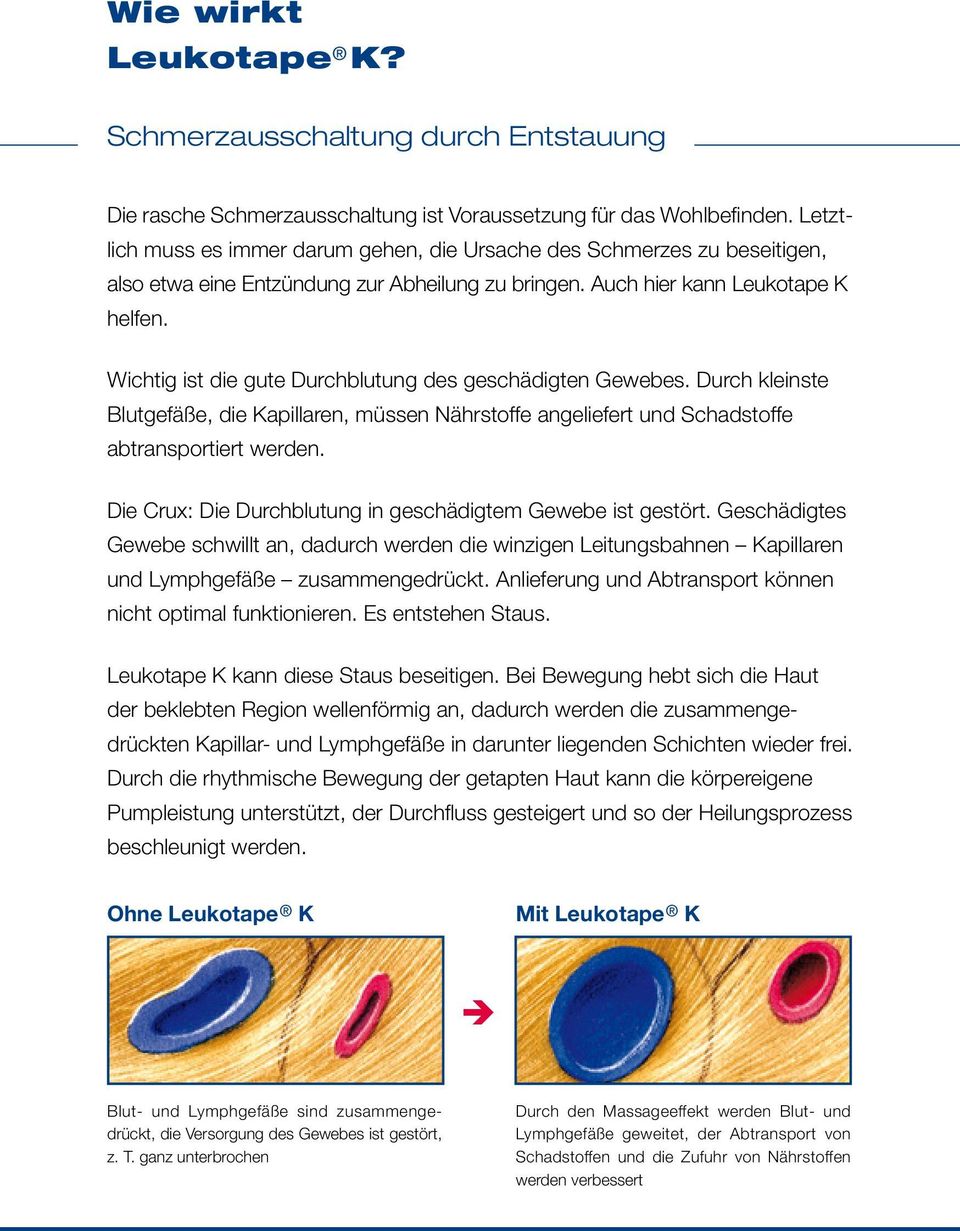 Wichtig ist die gute Durchblutung des geschädigten Gewebes. Durch kleinste Blutgefäße, die Kapillaren, müssen Nährstoffe angeliefert und Schadstoffe abtransportiert werden.