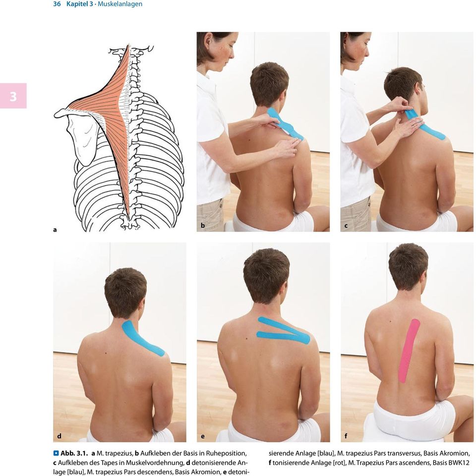 trpezius, Aufkleen der Bsis in Ruheposition, c Aufkleen des Tpes in