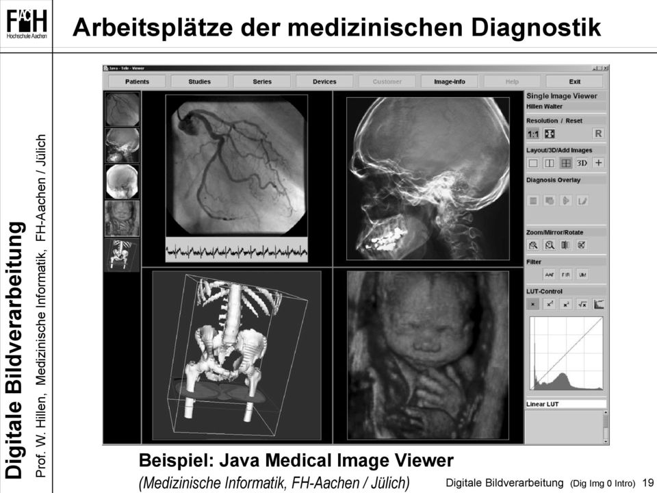 Image Viewer (Medizinische