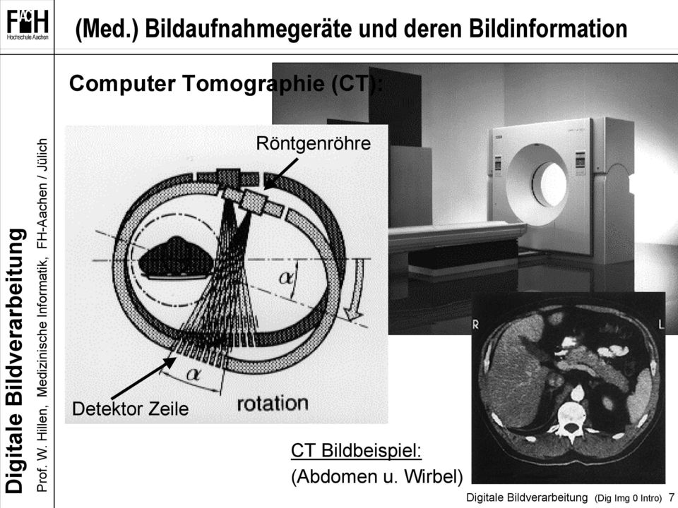 (CT): Detektor Zeile Röntgenröhre CT