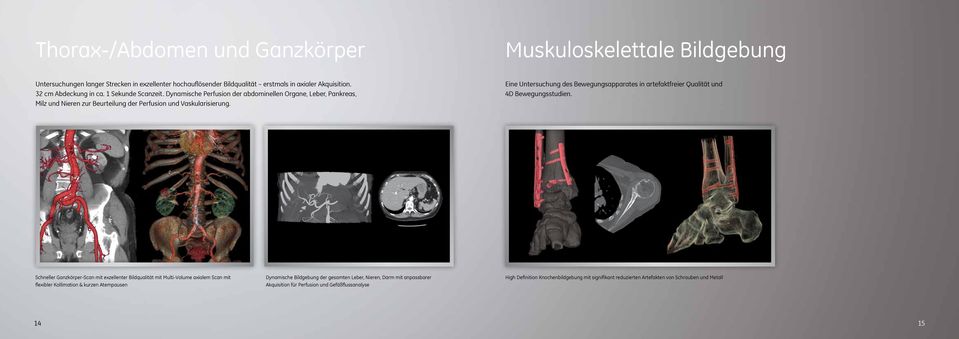 Eine Untersuchung des Bewegungsapparates in artefaktfreier Qualität und 4D Bewegungsstudien.