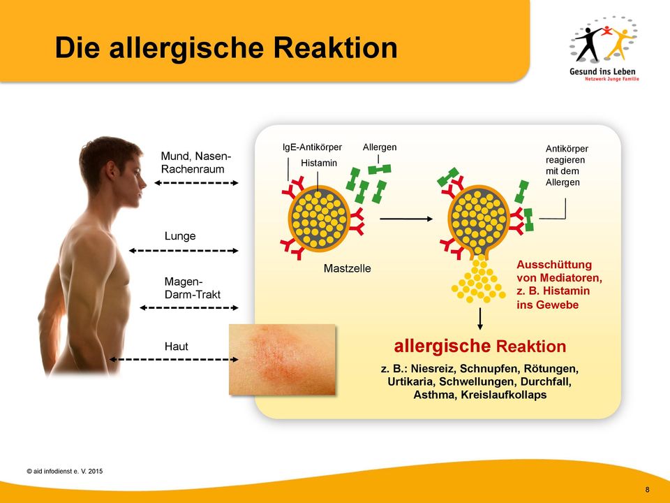 Ausschüttung von Mediatoren, z. B. Histamin ins Gewebe Haut allergische Reaktion z.