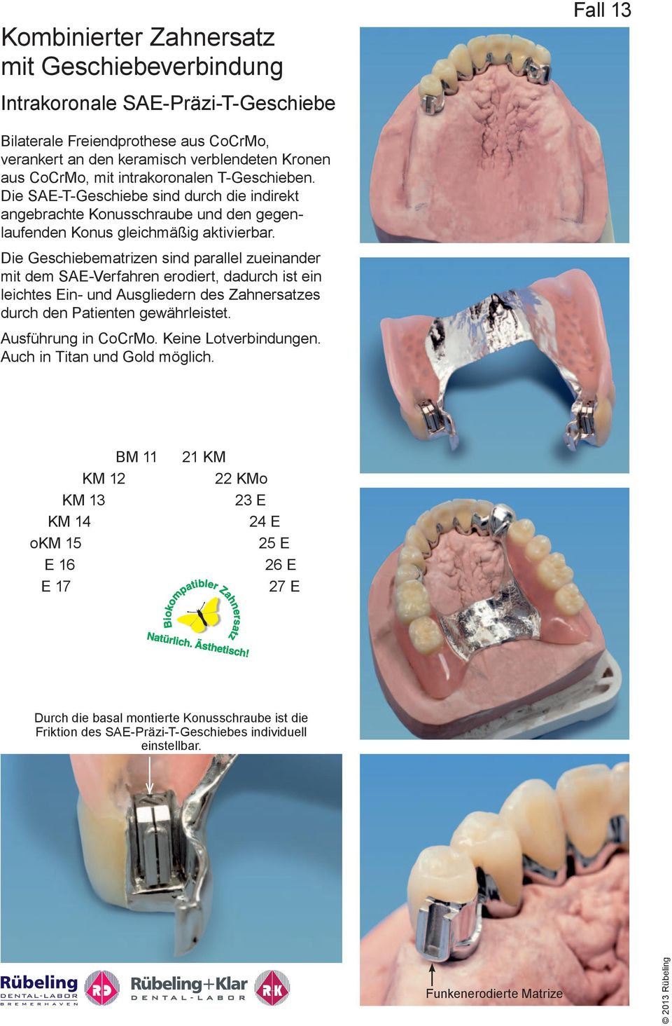 Die Geschiebematrizen sind parallel zueinander mit dem SA-Verfahren erodiert, dadurch ist ein leichtes in- und Ausgliedern des Zahnersatzes durch den Patienten gewährleistet. Ausführung in CoCrMo.