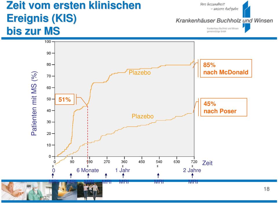 Plazebo 85% nach McDonald 45% nach Poser 0 MRI