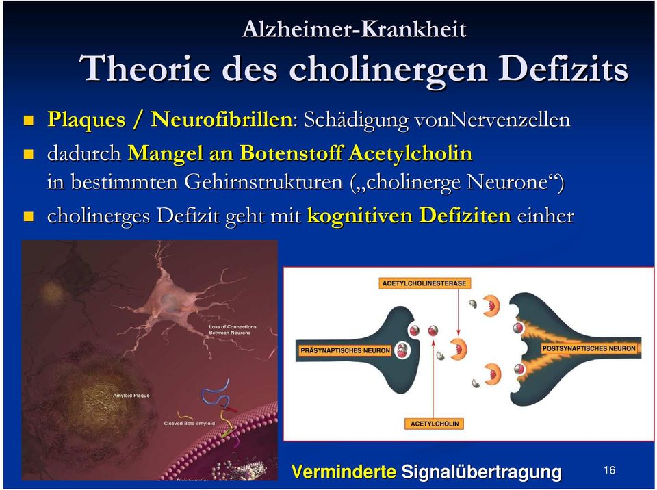 Gehirnstrukturen ( cholinerge Neurone ) cholinerges Defizit geht mit kognitiven