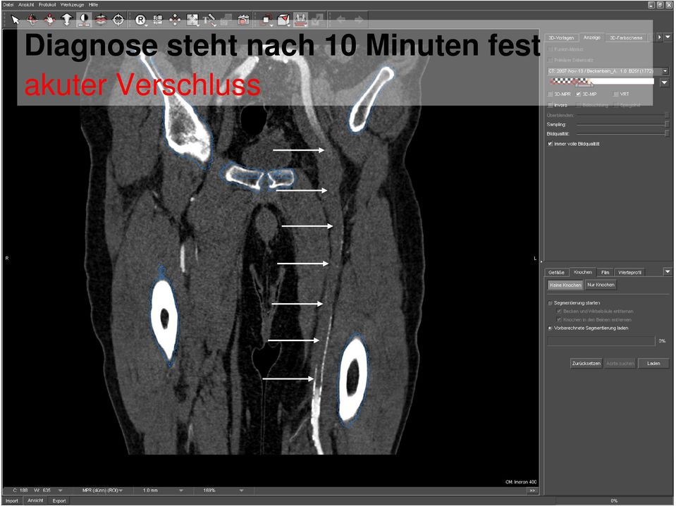 Minuten fest