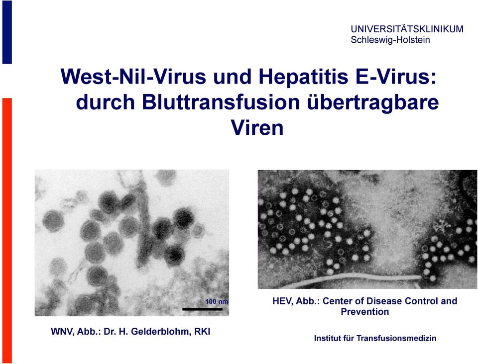 : Center of Disease Control and Prevention WNV, Abb.