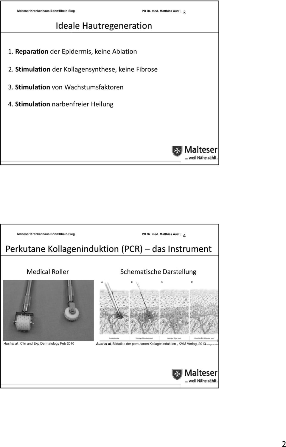 Stimulation narbenfreier Heilung Perkutane Kollageninduktion (PCR) das Instrument 4 Medical Roller