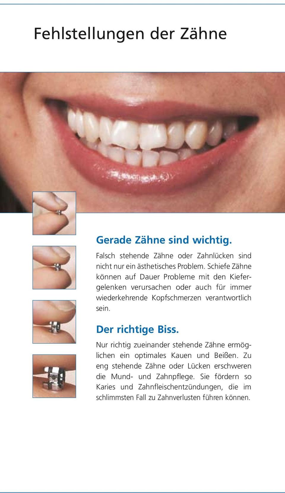 sein. Der richtige Biss. Nur richtig zueinander stehende Zähne ermöglichen ein optimales Kauen und Beißen.
