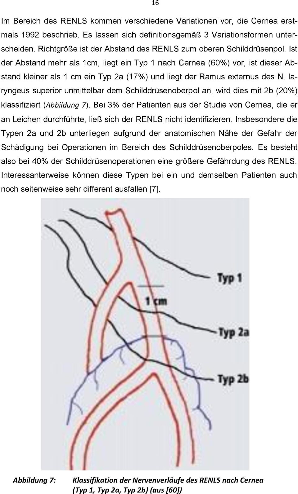 Ist der Abstand mehr als 1cm, liegt ein Typ 1 nach Cernea (60%) vor, ist dieser Abstand kleiner als 1 cm ein Typ 2a (17%) und liegt der Ramus externus des N.