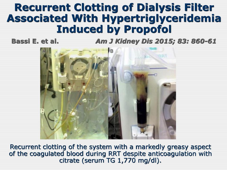Am J Kidney Dis 2015; 83: 860-61 Recurrent clotting of the system with a