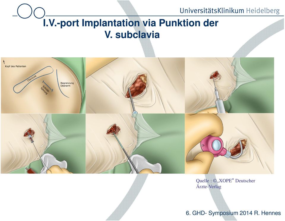 subclavia Quelle :