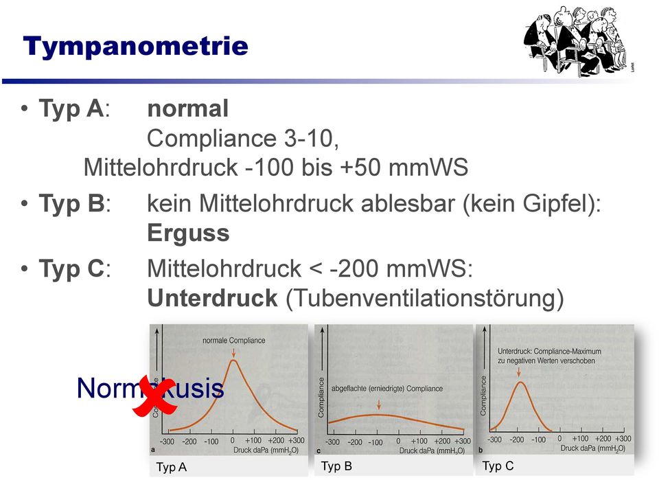 ablesbar (kein Gipfel): Erguss Mittelohrdruck < -200 mmws: