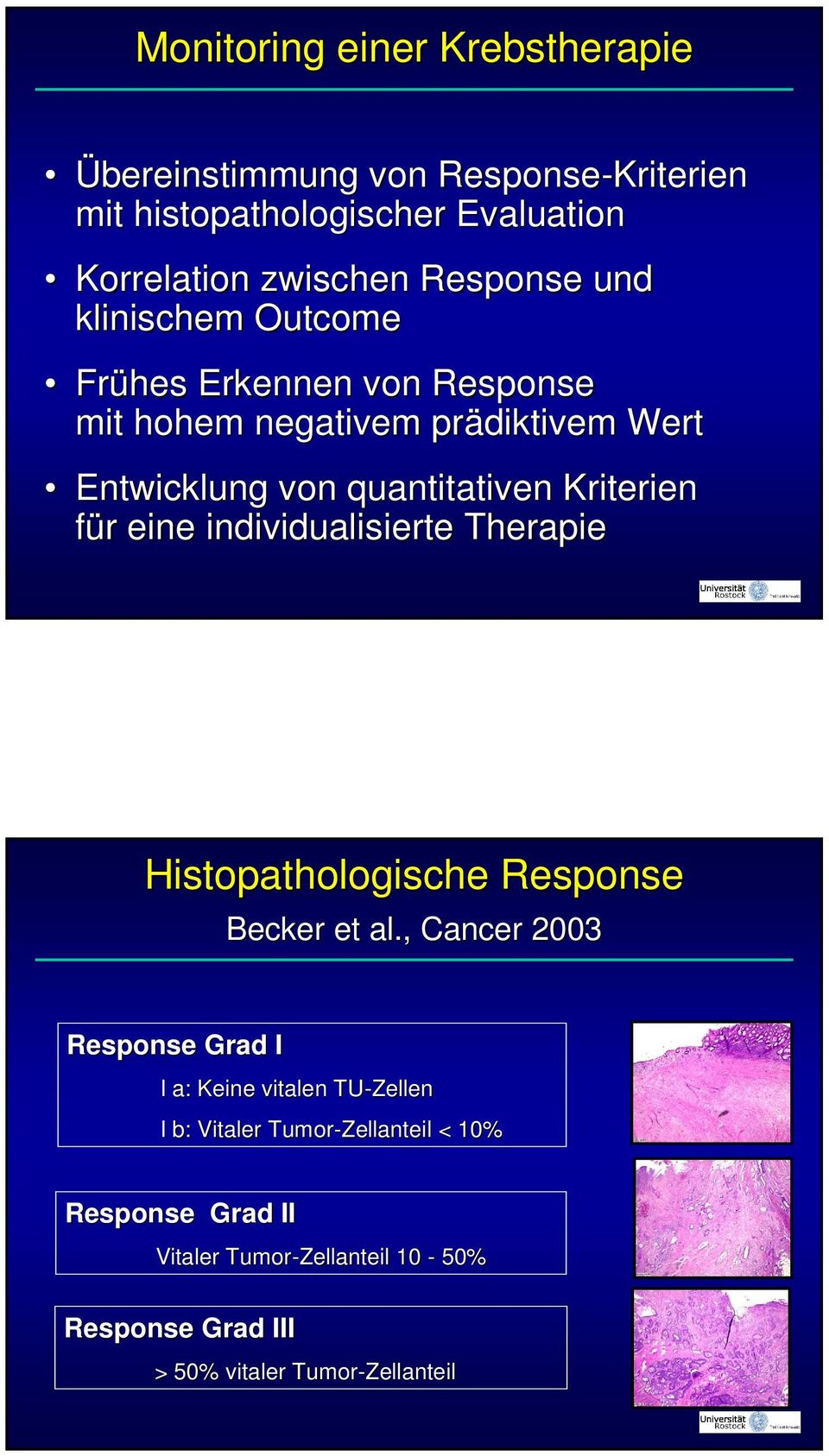 Kriterien für r eine individualisierte Therapie Histopathologische Response Becker et al.
